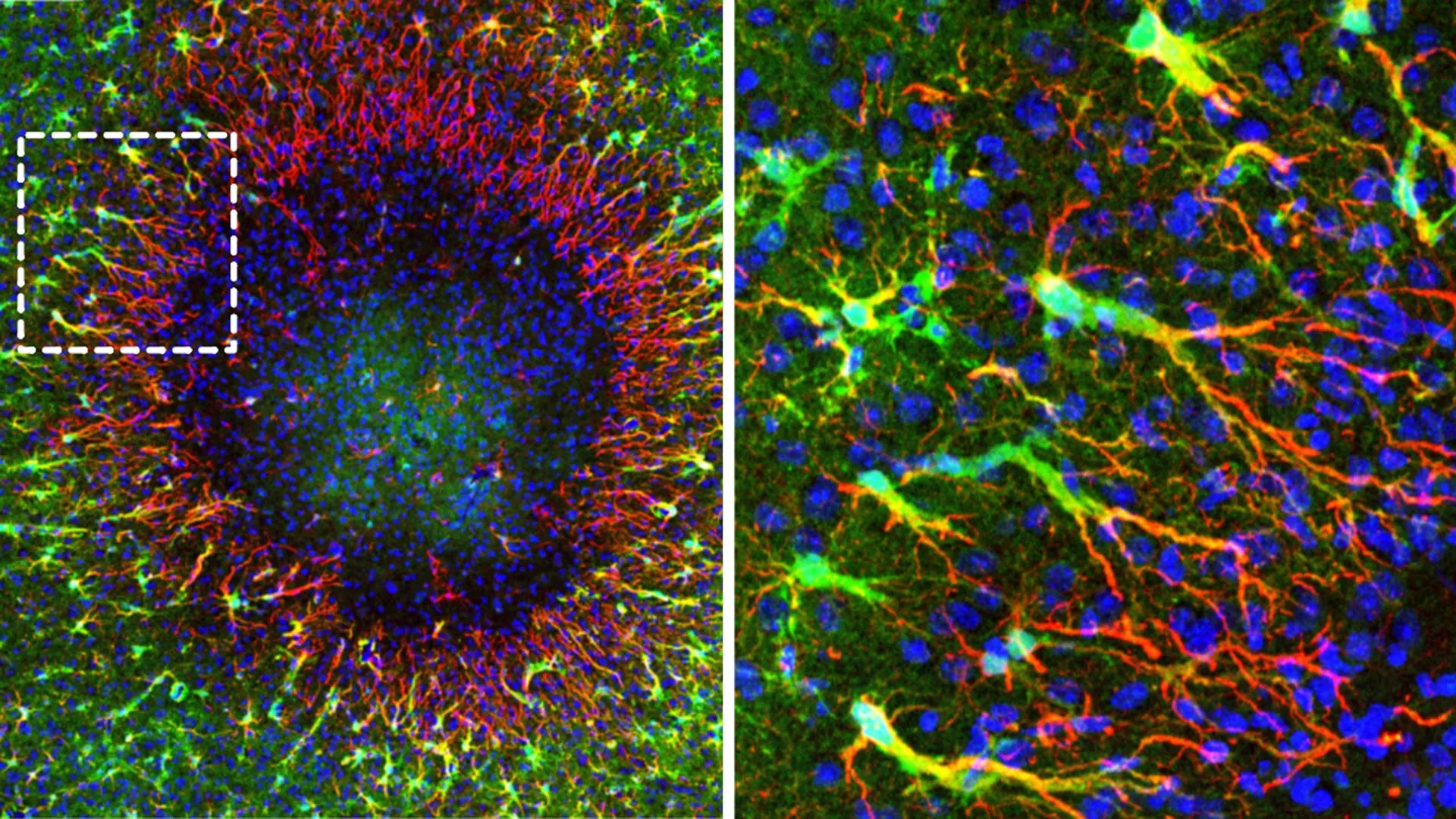 Adult Brains Show Unexpected Self-Repair Capability