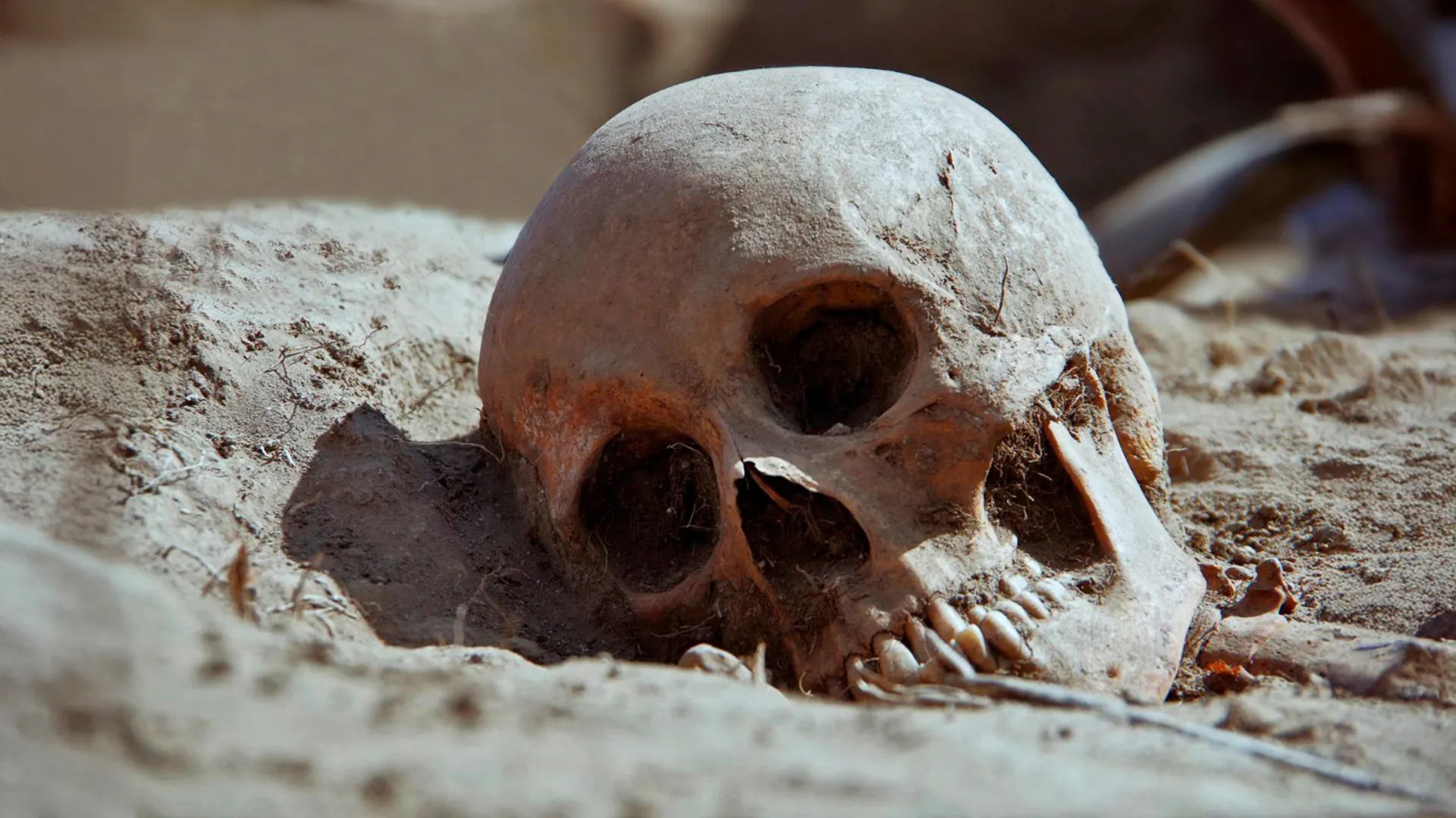 Ancient Skeletons Challenge Syphilis Understanding