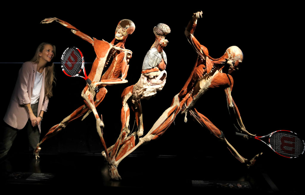 ‘Body Worlds’ Creator Gunther von Hagens Dies at 81