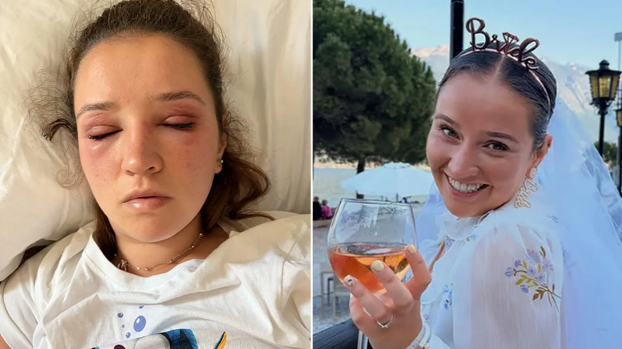 Bride Hospitalized After Wedding Beauty Treatment
