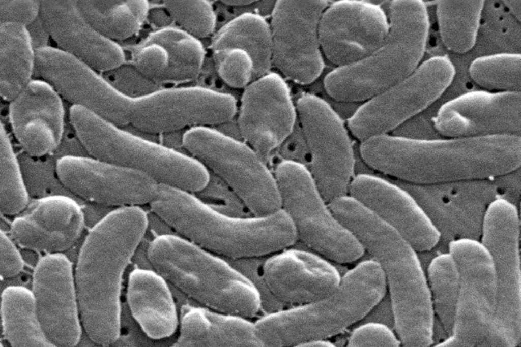 Aumento de Infecciones Bacterianas Mortales en la Costa del Golfo, Provocando Advertencias Sanitarias
