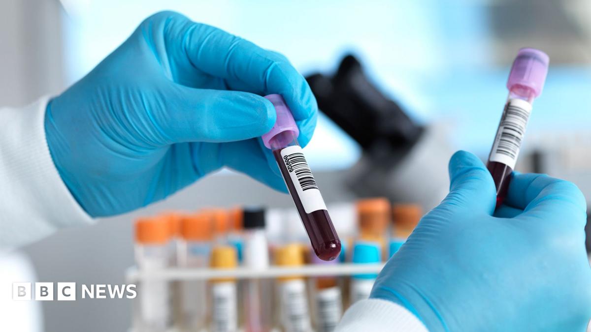 England plant, Hepatitis C Jahre früher als geplant zu eliminieren