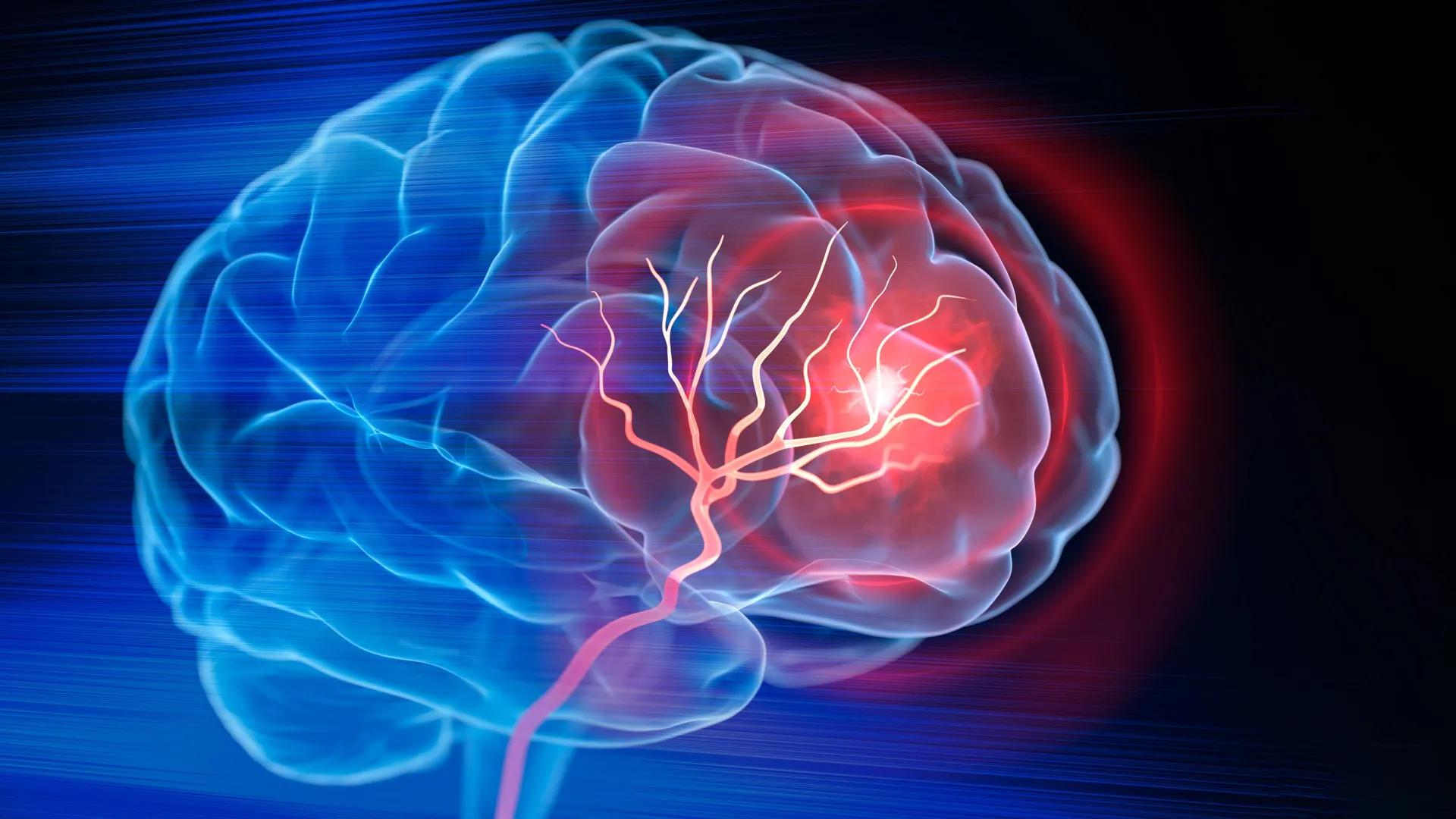 Injectable Scaffold Aids Brain Recovery After Stroke in Mice