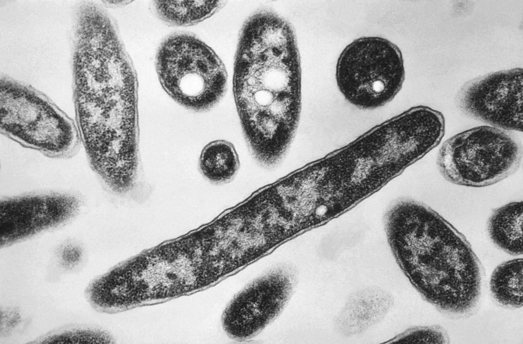 纽约爆发军团菌病，造成三人死亡、72人感染