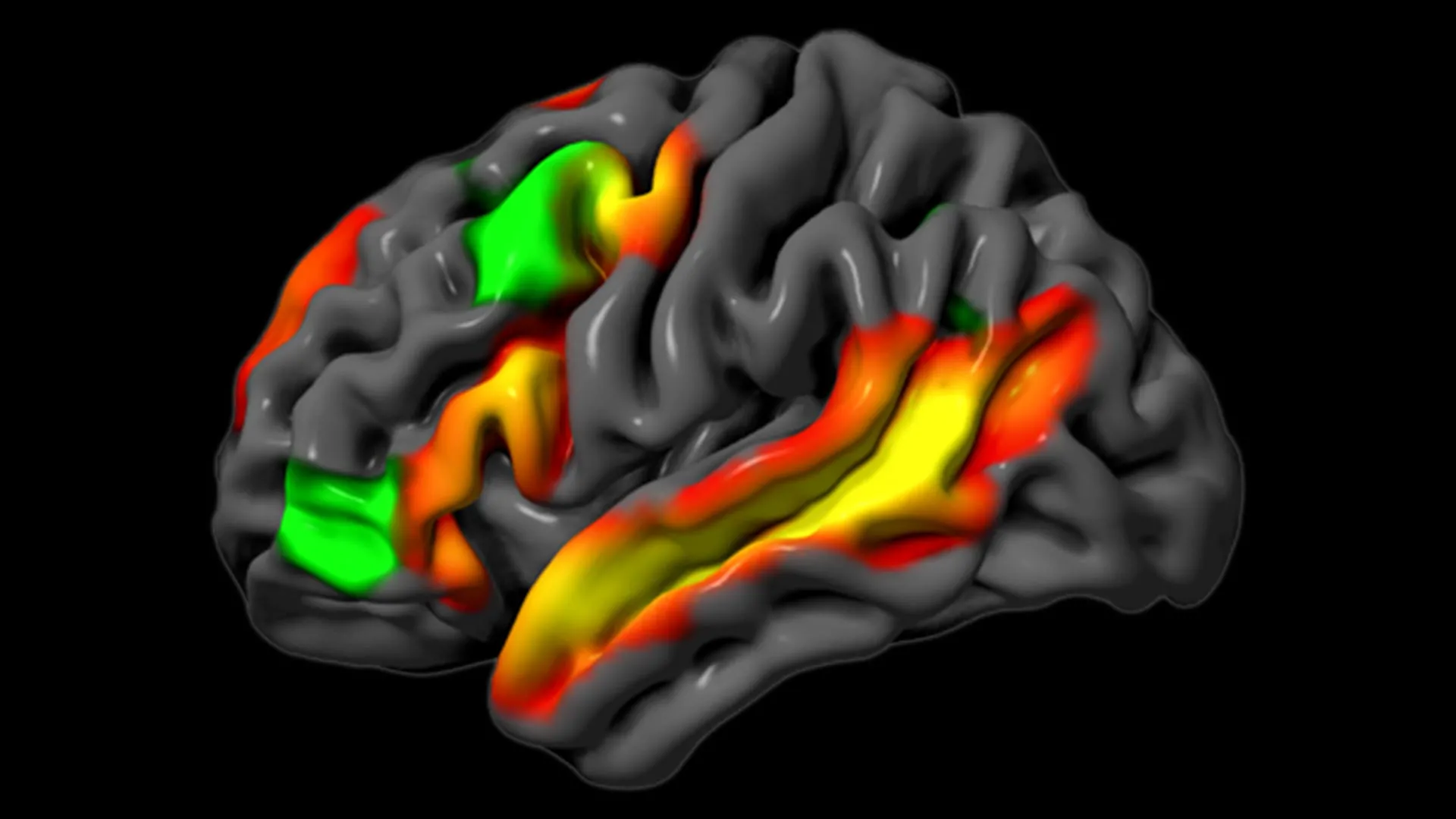 MIT Study Shows Brain Can Reason Without Language