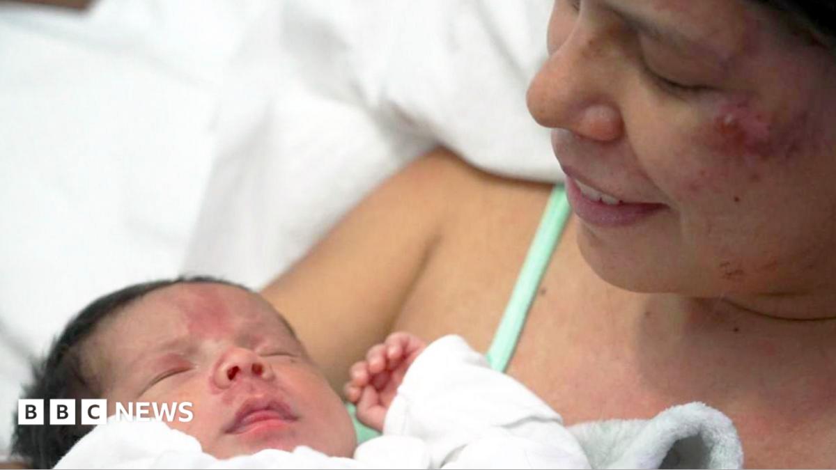 Mom and Newborn Rescued from Rubble in Venezuela After Earthquake