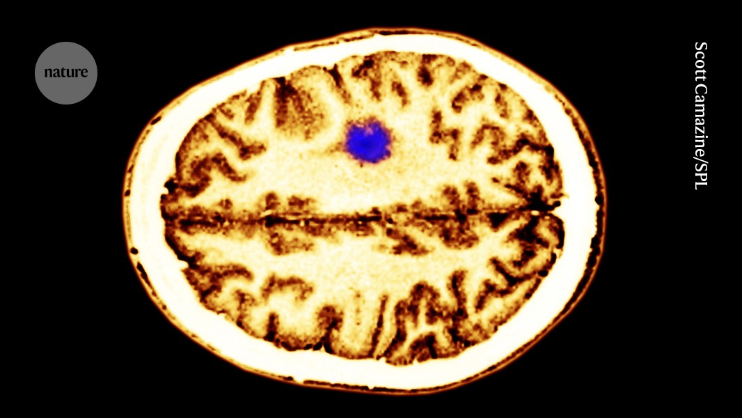 Neurons Found to Inhibit Nervous System Cancer