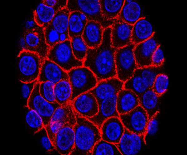 Researchers Report Novel Pill Extends Survival for Advanced Pancreatic Cancer Patients