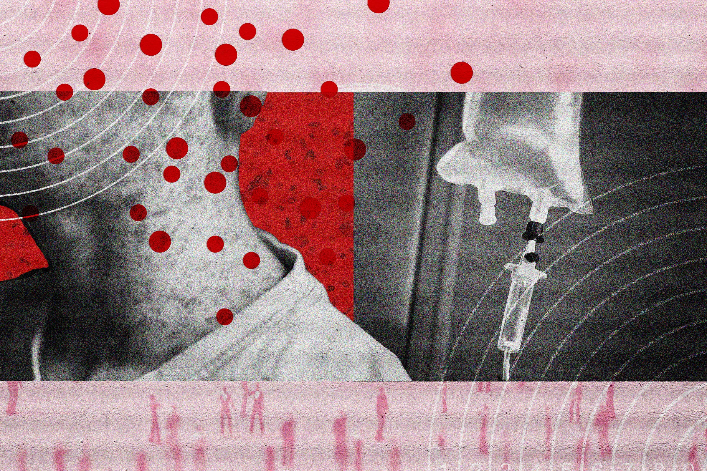 Rising Measles Cases Prompt Search for Treatments