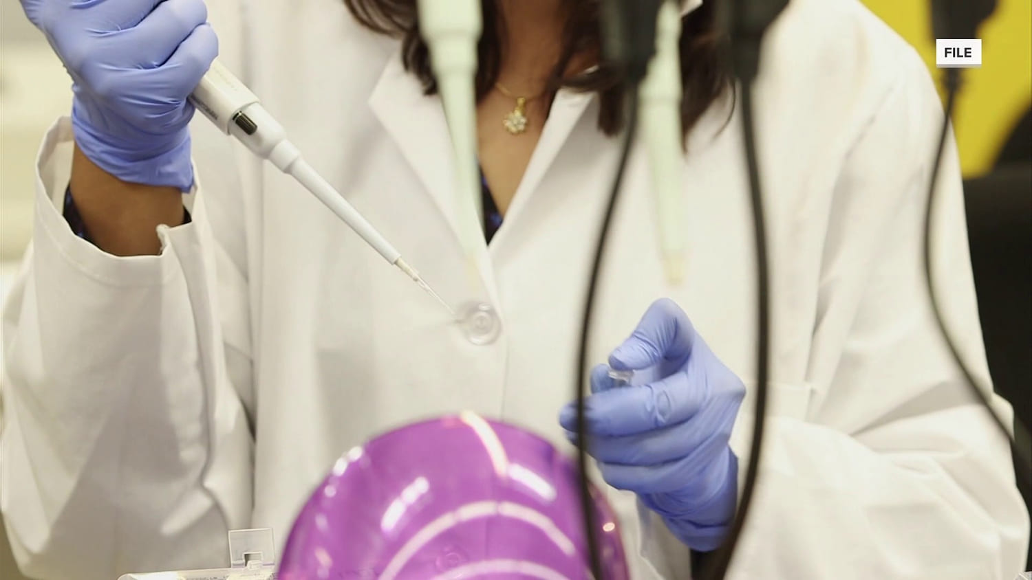Russian Lab Worker Dies After Potential Plague Exposure, Prompting Quarantine