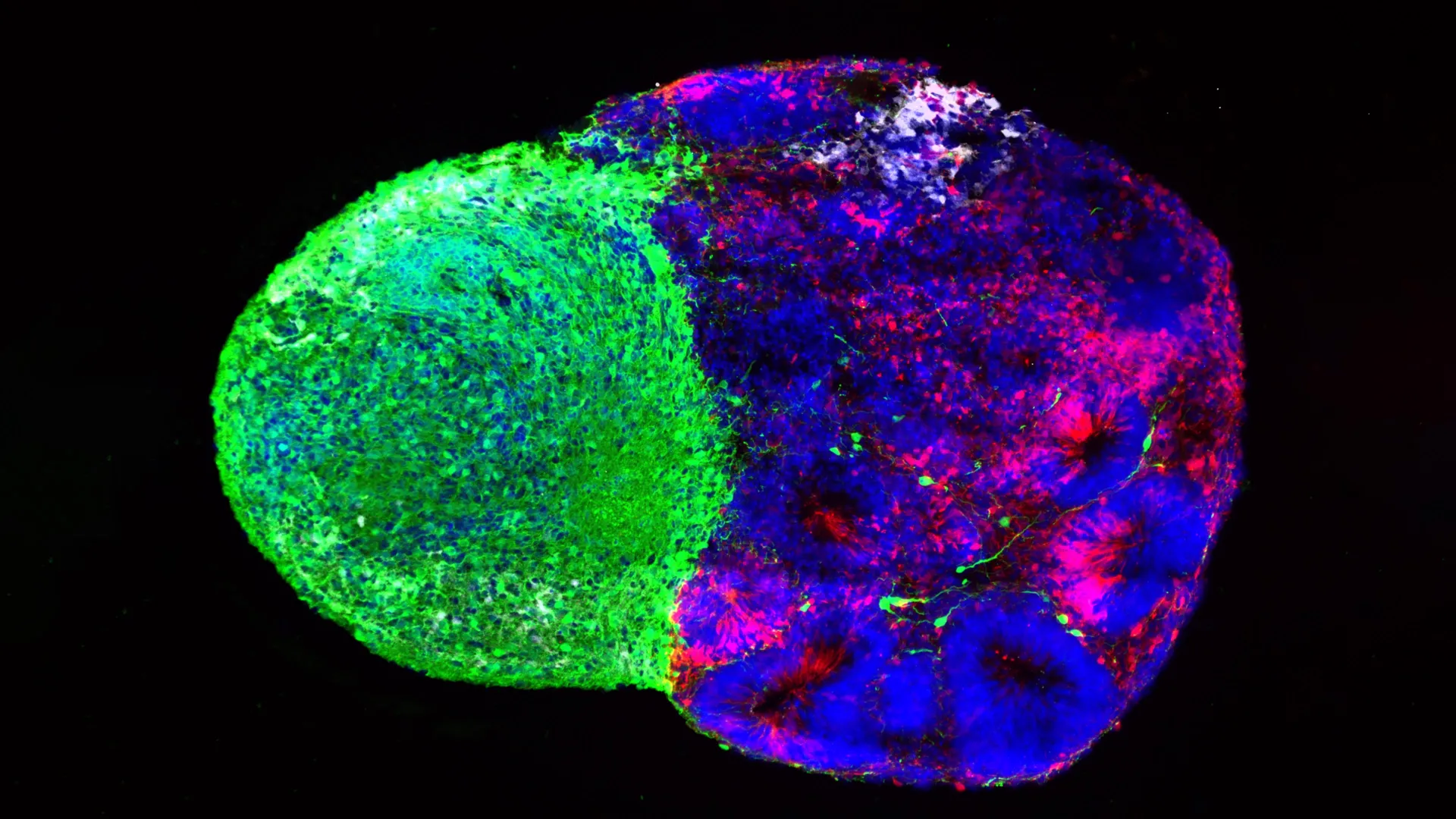 Scientists Detail How Human Brains Develop From Stem Cells