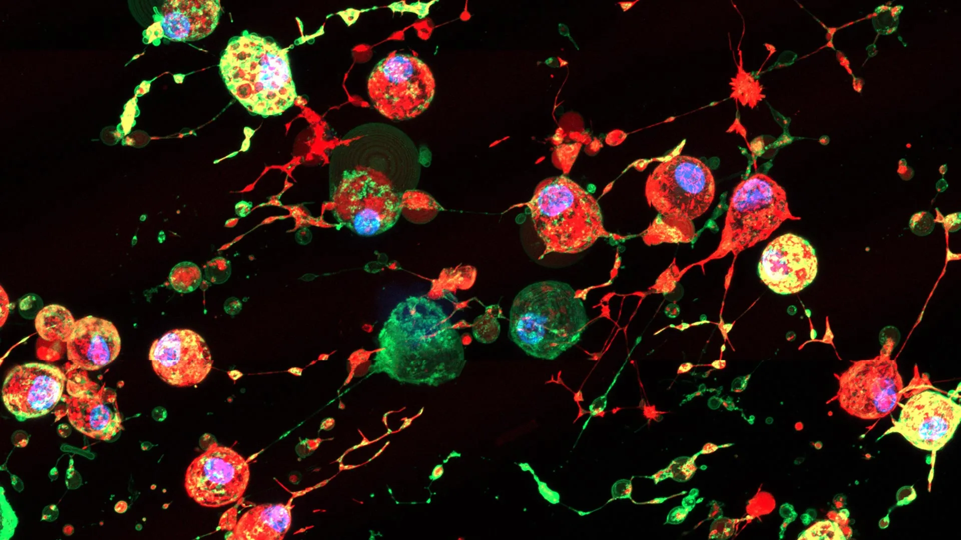 Scientists Discover Viruses Exploit Cell Death Footprints