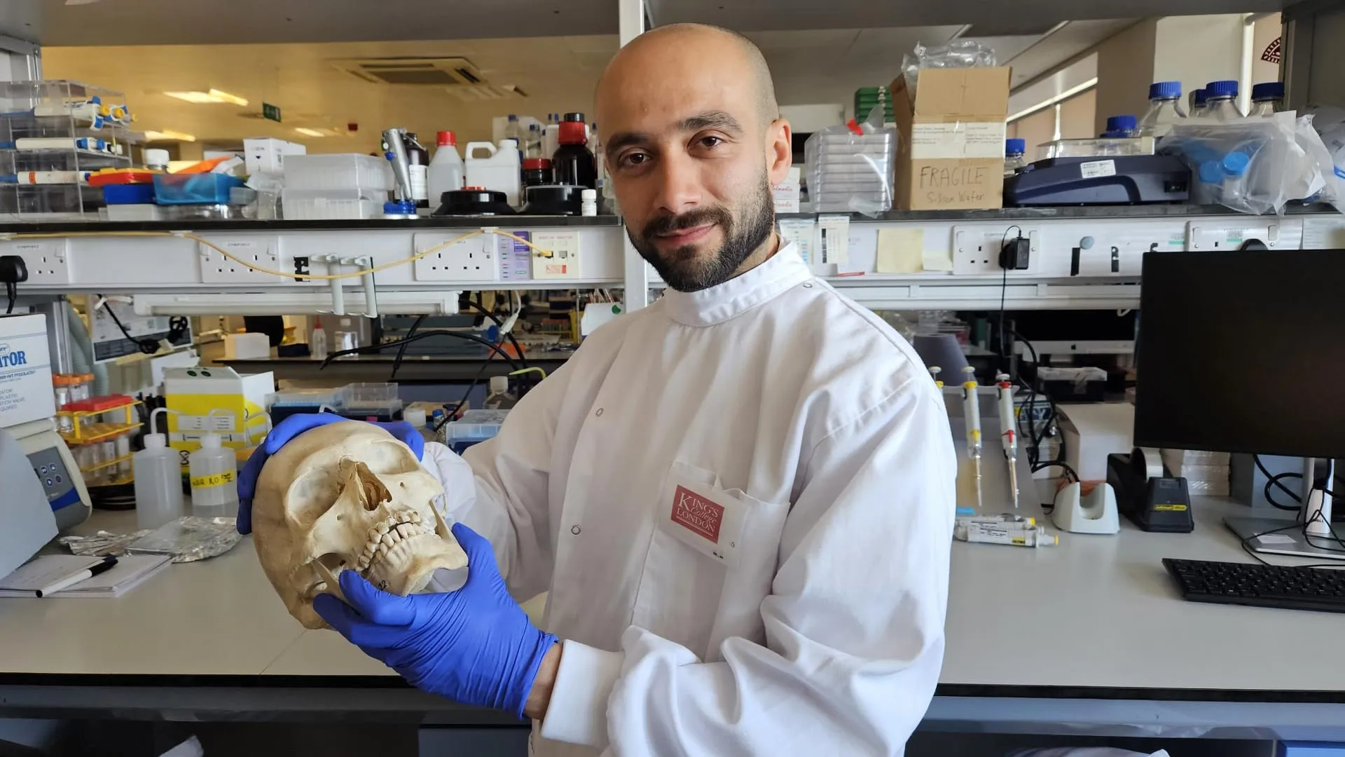 Sheep’s Wool Shows Promise in Bone Regeneration
