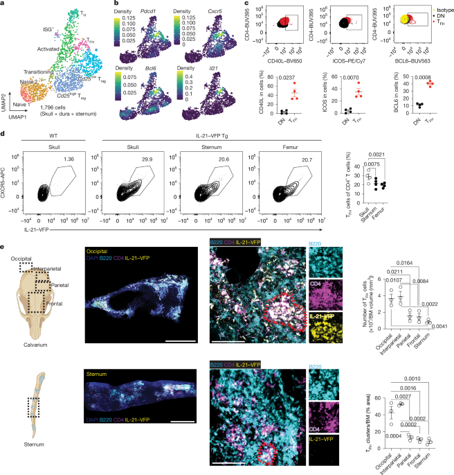 Skull Lymphoid Structures Key to Brain Immune Response