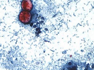 Taco Bell Removes Lettuce From Some Locations Amid Cyclosporiasis Investigation