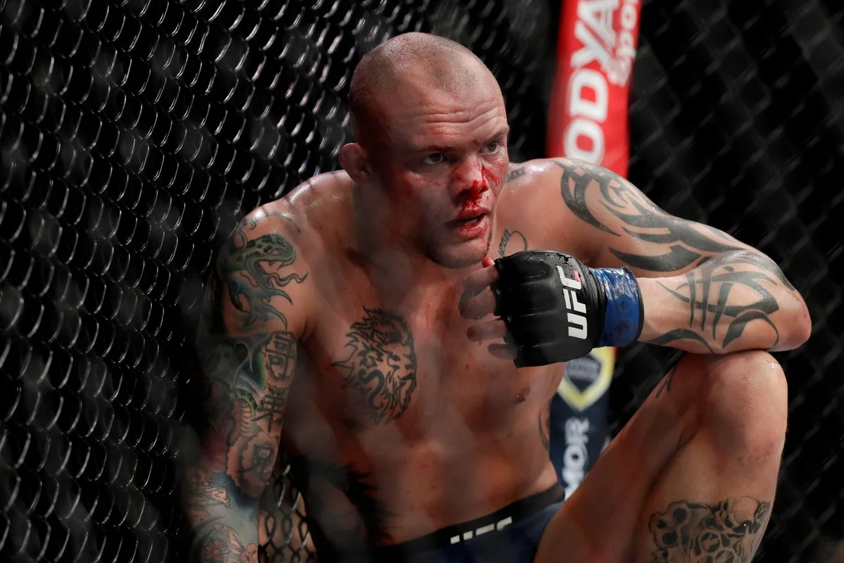UFC के एंथनी स्मिथ को गंभीर आरोपों में गिरफ्तार किया गया